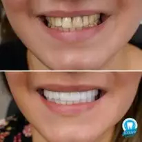 Slider image (4) Turkiye Dental